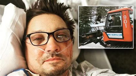 Jeremy Renner Accident: Actors Recovery After Snowplow。